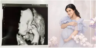 Suami Audy Marissa Cerita Soal Baby Shower Jelang Persalinan Prematur