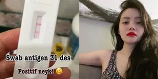 Mawar AFI Positif Covid-19, Sudah Kembali Bisa Mencium Aroma di Hari ke-8 Karantina