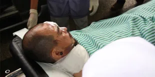 Membaik, Beery Saint Loco Akan Jalani Operasi Plastik?