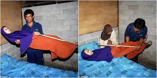 Miris, Karena Peyakit Langka Tubuh Wanita Ini Kaku Bak Papan