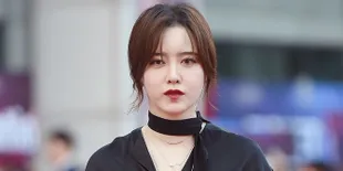 Naik 10 Kg, Goo Hye Sun Dikira Hamil dan Lakukan Operasi Plastik