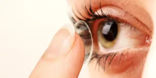 Ngeri! Seorang Wanita Nyaris Buta Karena Tak Lepas Soft Lens 5 Bulan