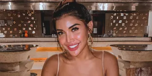 Pamer Cleavage di Foto Terbaru, Netizen Sebut Payudara Millendaru Miring Sebelah