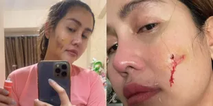 Pedangdut Ratu Meta Unggah Video Cekcok dengan Suami, Ungkap Kekerasan yang Diduga KDRT