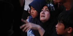 Pipik Dian Irawati dan Anak Luka Bakar di Kaki