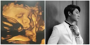 Potret Calon Bayi Lesti &#38; Rizky Billar, Hidung Mancung Mirip Papanya Banget!