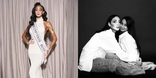Potret Cantik Logina Salah, Miss Universe Mesir Pertama dengan Vitiligo dan Status Ibu