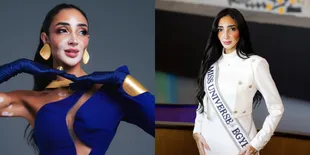 Profil Logina Salah, Miss Universe Mesir 2024 yang Buktikan Vitiligo Bukan Penghalang