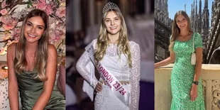 Profil Natasha Beresford, Miss London 2023 Pemenang Kontes Kecantikan Tanpa Makeup Pertama di Dunia