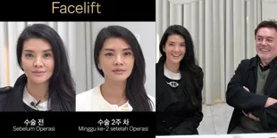 Putuskan Lakukan Operasi Plastik, Perubahan Wajah Farah Quinn Kini Jadi Lebih Terlihat Muda