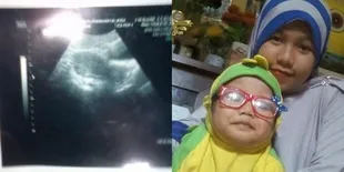 Rahim Infeksi Akibat Suntik KB, Wanita Ini Berbagi Pengalaman Pilunya