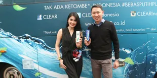 Rambut Bebas Ketombe seperti Sandra Dewi, Mau Tahu Caranya?