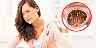 Sakit Perut Berbulan-Bulan, Ternyata Di Dalam Tubuh Gadis Ini Ada