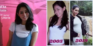 Saphira Indah Meninggal Dunia Pasca Sesak Napas Saat Hamil, Kondisi Ini Bisa Diatasi?