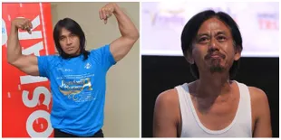 Selain Agung Hercules, 2 Seleb Tanah Air Ini Juga Terkena Penyakit Otak