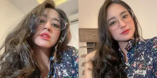 Selalu Tampil Cantik dan Seksi, Dewi Perssik Percaya Diri Unggah Foto Burket