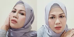 Selfie Terbaru Elly Sugigi Pakai Behel yang Makin Bikin Pangling, Tanya Sudah Bisa Mingkem Apa Belum