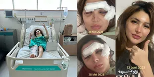Leher Sempat Dipasang Penyangga hingga Kaki Dipen, Ini Potret Terkini Angela Lee Usai Kecelakaan: Sudah Dikasih Kesempatan Hidup Kedua