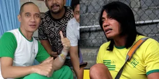 Seputar Glioblastoma, Kanker Otak Yang Diderita Agung Hercules