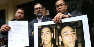 Setelah Dianiaya Oknum Polisi, Axel Thomas Jadi Tersangka Narkoba