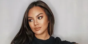 Shafa Harris Pamer Stretch Marks di Pahanya, Tunjukkan Sisi Body Positivity