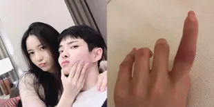 Usai Mengaku Hampir Dibunuh, Han Seo Hee Unggah Fotro Tangan Memar