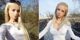 Valeria Lukyanova Luka Parah Setelah Diserang dan Dihajar