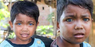 Viral! Bocah Bermata Biru Asal Sulawesi Ini Dikira Pakai Softlens Ternyata Asli