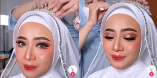 Viral, MUA Ciptakan Riasan Pengantin Memukau untuk Penderita Vitiligo yang Bikin Terpukau
