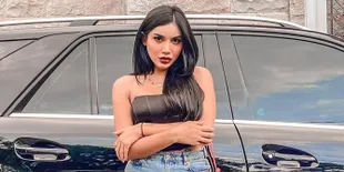 Wajahnya Terlihat Berbeda di Foto Terbaru, Millendaru Dibilang Mirip Kylie Jenner - Kim Kardashian
