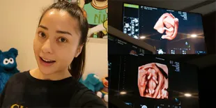 10 Potret Nikita Willy Jalani USG, Sosok Buah Hati di Dalam Perut Jadi Sorotan - Wajah Indra Priawan Sampai Tegang