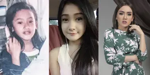 10 Potret Transformasi Cita Citata, Punya Pipi Chubby dan Sudah Cantik Sejak Dulu