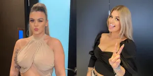 10 Potret Vicky Rog, Gadis Asal Inggris yang Viral Setelah Galang Dana untuk Kecilkan Ukuran Payudara