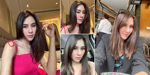 10 Potret Wajah Syahnaz Sadiqah yang Terlihat Berbeda dari Sebelumnya, Diduga Oplas Hidung oleh Netizen