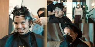 11 Potret Atta Halilintar Transplantasi Rambut di Turki, Tutupi Kepala Botak Pakai Topi - Batal Tanam Jenggot Karena Nggak Kuat Tahan Sakit