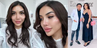 11 Potret Wajah Baru Millen Cyrus yang Di-filler Biar Mirip Angelina Jolie, Netizen Heboh Sebut Makin Aneh
