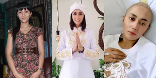 15 Potret Transformasi Aida Saskia Dari Awal Karier Sampai Kini Berjuang Melawan Kanker Payudara - Jalani Kemoterapi Sampai Kini Alami Kebotakan