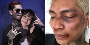 5 Kontroversi Young Lex yang Dikecam Fans K-Pop, Lecehkan Lisa BLACKPINK - Plagiat MV Lay EXO