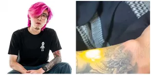 6 Potret dr. Tirta Hapus Tato Kesayangannya, Rela Tahan Sakit Saat Proses Penghapusan Demi Sang Anak 