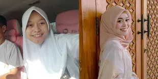 7 Perawatan Wajah yang Dilakukan Lesti Sejak Tahun 2014, Disinyalir Rutin Rogoh Kocek Lebih dari Rp15 Juta Per Bulan - Nyata Bedanya