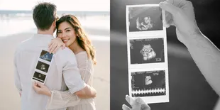 7 Potret Aline Adita Hamil Setelah 7 Tahun Program Bayi Tabung, Bahagia Ungkap Rasa Syukur