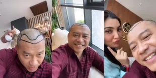 7 Potret Anang Hermansyah Pamer Kepala Botak, Bakal Tanam Rambut yang Makin Menipis di Turki - Bikin Penasaran Sama Hasilnya