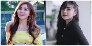 7 Potret Chacha Sherly Mantan Personel Trio Macan, Alami Kecelakaan Beruntun Hingga Mobil Ditabrak dari Arah Berlawanan