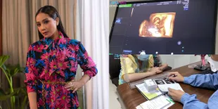 7 Potret Janin Nagita Slavina yang Berusia 10 Minggu, Tumbuh Sehat dan Sudah Terlihat Kaki-Tangannya - Bikin Ibunya Nangis Terharu