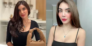 7 Potret Millen Cyrus Semakin Cantik dengan Gigi di Veneer, Perawatannya Sampai Habiskan Ratusan Juta Bikin Salah Fokus