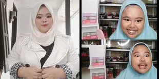 7 Potret Pengalaman Kekeyi Ciuman dengan Gebetan Barunya Sampai Bibir Terluka, Kisah 18+ yang Membagongkan