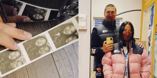 7 Potret Terbaru Daniel Adnan dengan Kepala Gundul, Makin Ganteng Pamer Hidung Mancung - So Sweet Bareng Tara Basro