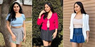 7 Potret Terbaru Transgender Stasya Bwarlele yang Semakin Langsing dan Bikin Pangling di Amerika, Kaki Jenjangnya Jadi Sorotan