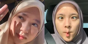 8 Foto Close Up Nissa Sabyan yang Cantik dengan Mata Coklat dan Lesung Pipinya