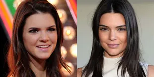 8 Foto Keluarga Kardashian Sebelum & Sesudah Operasi, Beda Jauh!